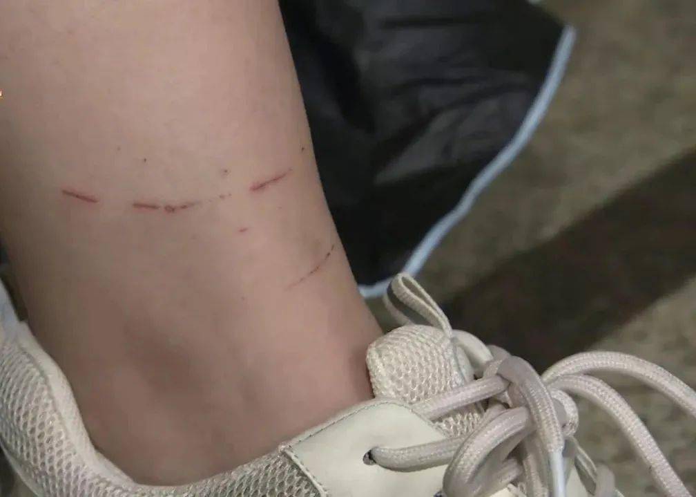 哈佛星城流浪猫伤人花费二千元该谁买单