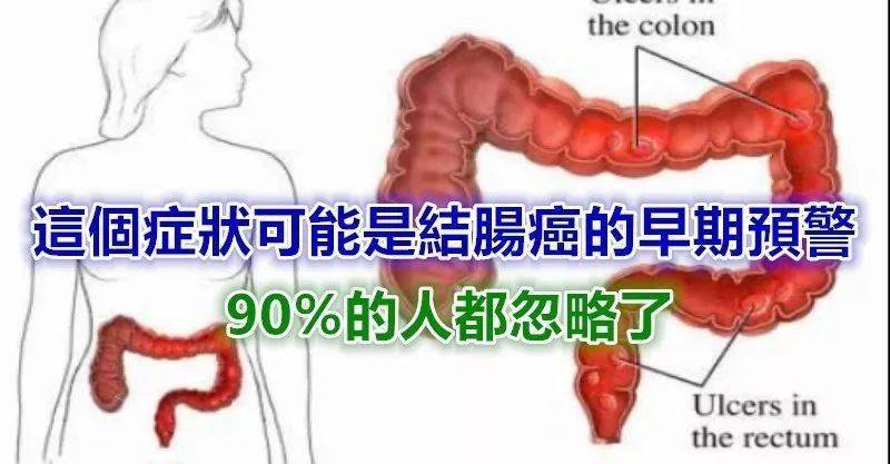 肠癌三多一痒图片