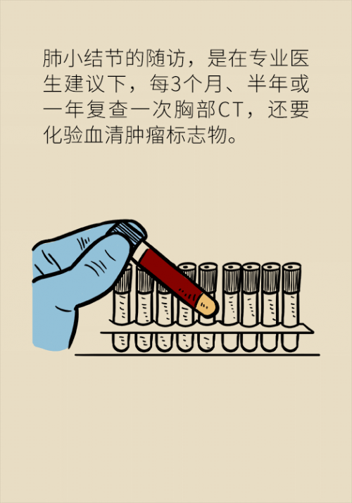 肺部|肺部有6毫米结节用开刀吗？请注意这些关键词