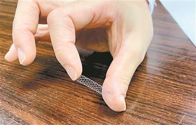 血管|肺动脉狭窄患儿有了“救命支架”