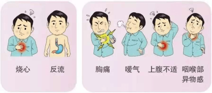 括约肌|大咖坐诊丨得了胃食管反流病怎么办？消化内科专家为您全面解析