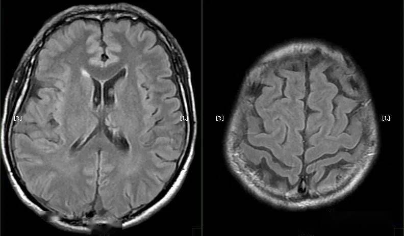 什么样的mri图像才是好图像!