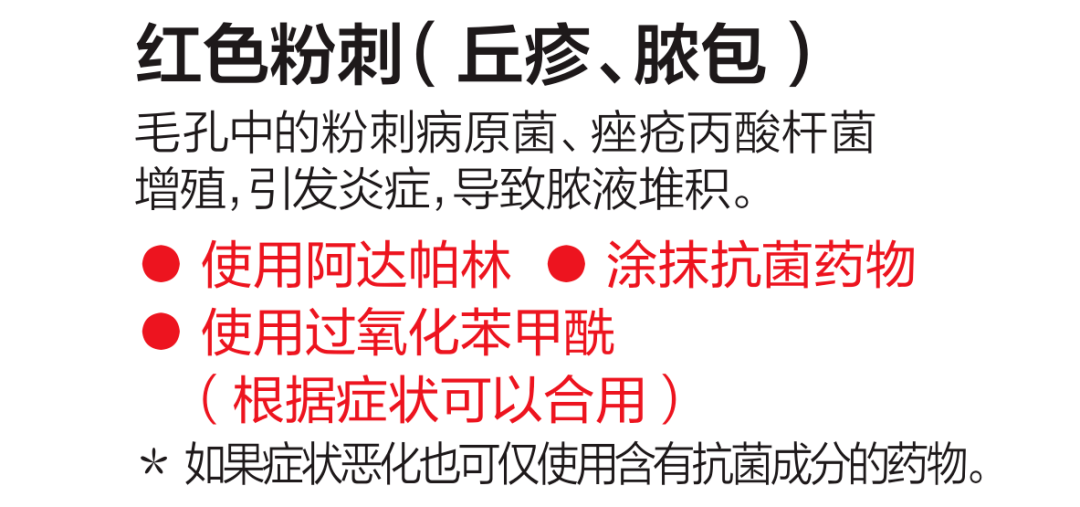 治疗|刘雨昕遮痘磨皮，尹净汉用痘痘贴，对抗粉刺你还需要这些！