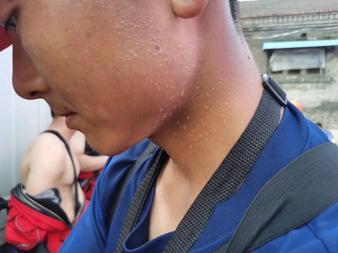 皮肤晒得黝黑,脚部溃烂加重,衣服倒出汗水.你"狼狈不堪",我心疼不已