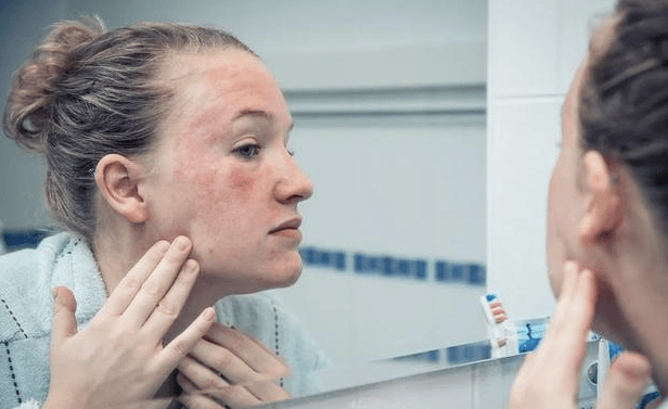 吴玉波|如何做一个不“敏感”的人？尽量避开过敏原