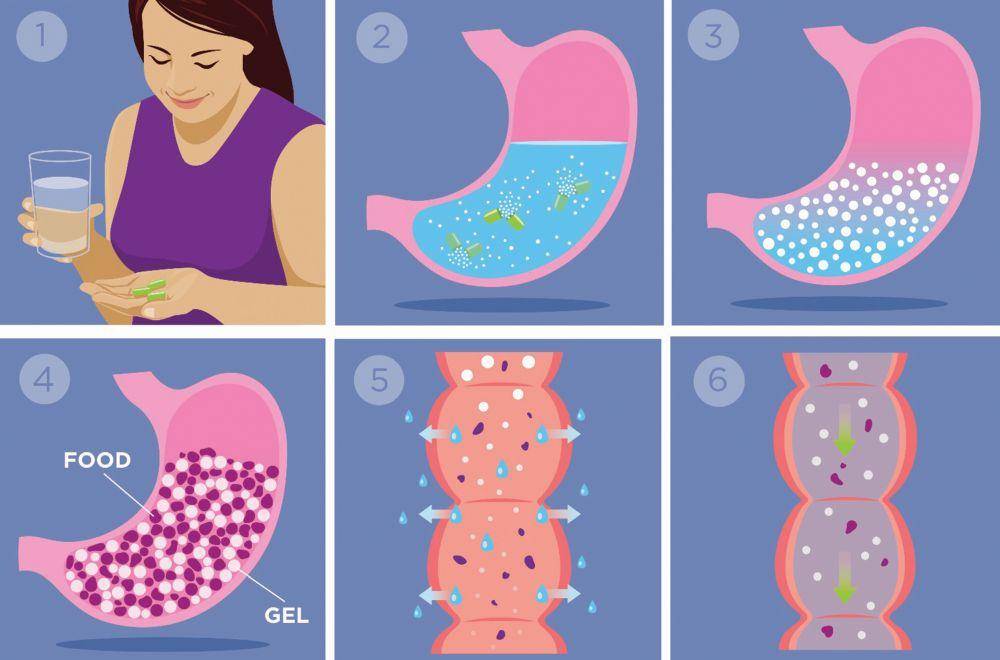 UpToDate|为了减肥切掉胃，不是偷懒，是救命
