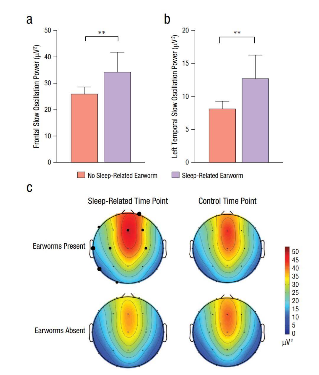 Music|一闭上眼就响起洗脑神曲？“魔音绕脑”原来是“耳虫”在作祟
