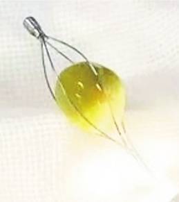 医学科|男子吃饭太快青豆卡住气管