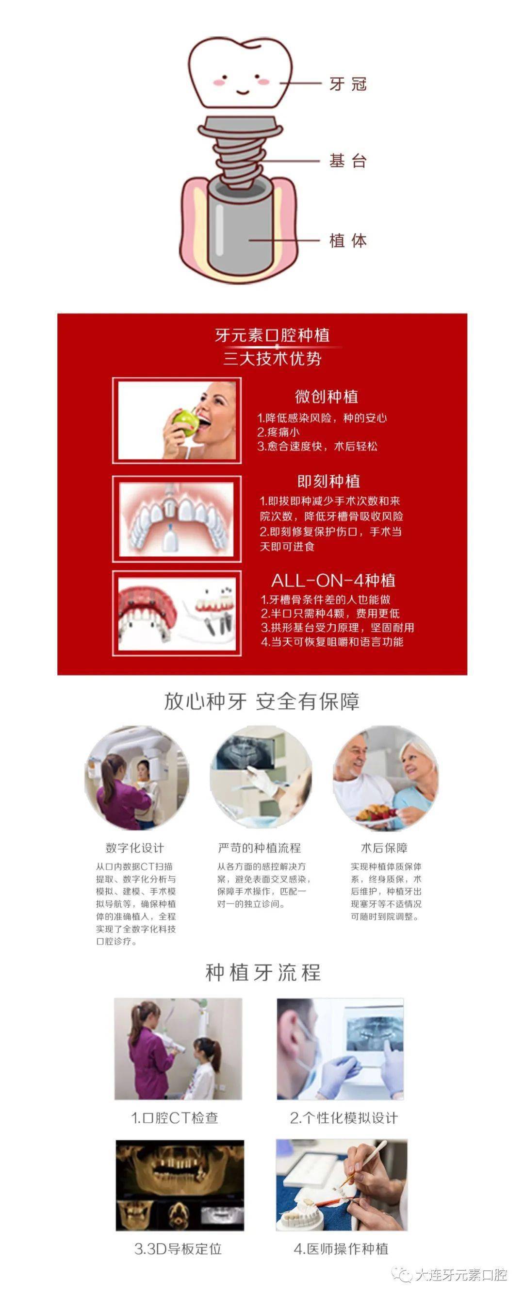 牙冠|限时特惠：进口种植牙1988元（植体+基台+牙冠）