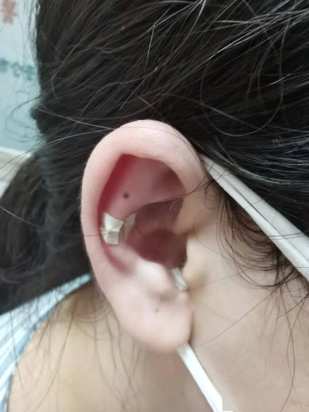 耳穴埋豆图《灵枢·口问》有言:耳为宗脉之所聚.