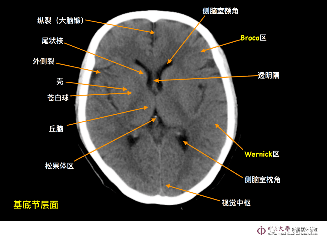 超实用 急诊头颅ct