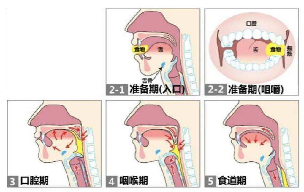 吞咽上肢手功能一体化吞咽功能的拆解
