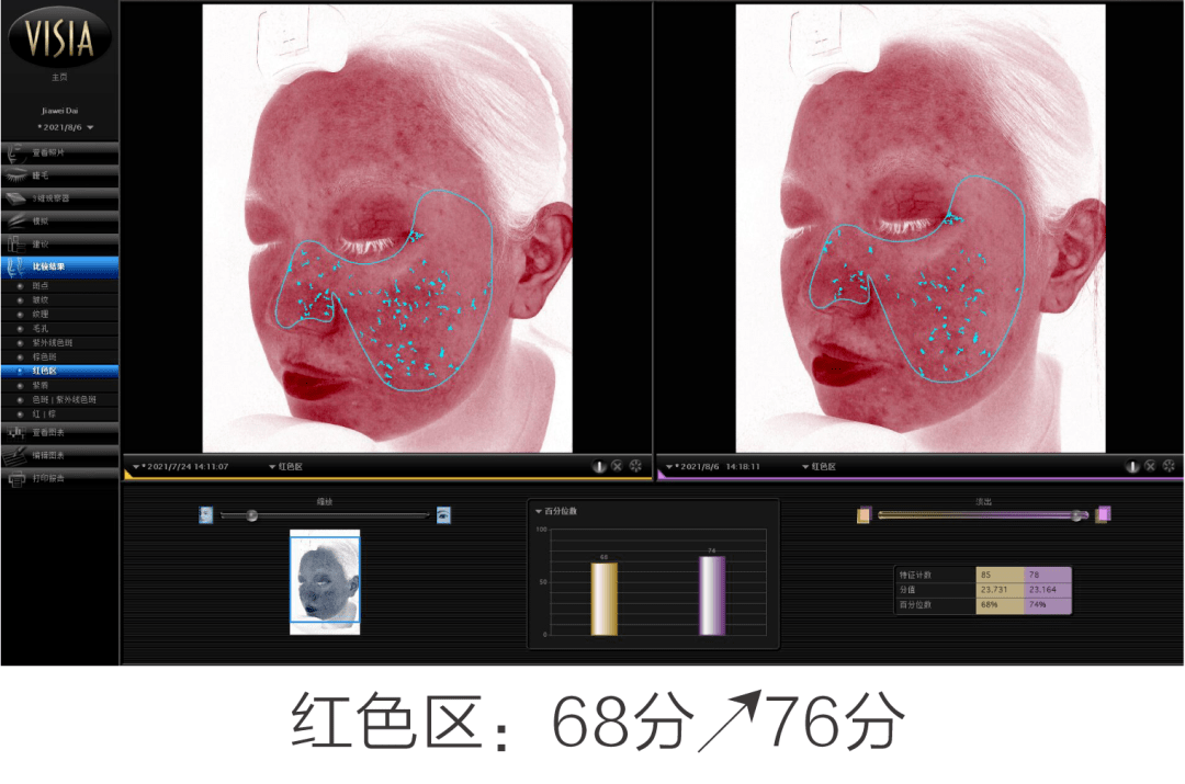 氛围|高阶评测 | 有效抗初老，氛围组out 实力组in！