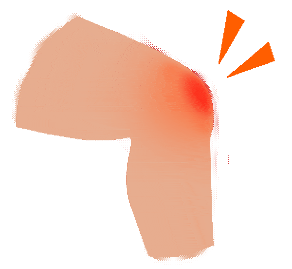 饮食|糖尿病怎么控制血糖？记住这些就够了