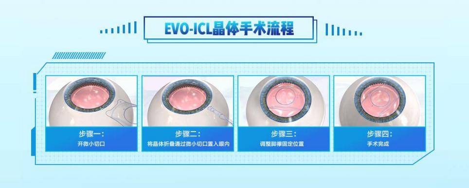 眼底|近视人群中有三成高度近视，致盲性并发症发生率将大增