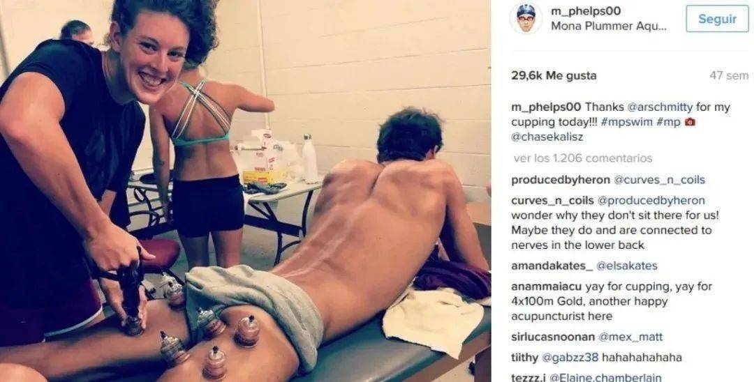 拔罐为什么疼 c6912f4fbd35423b97088ac87e02aad7.jpeg