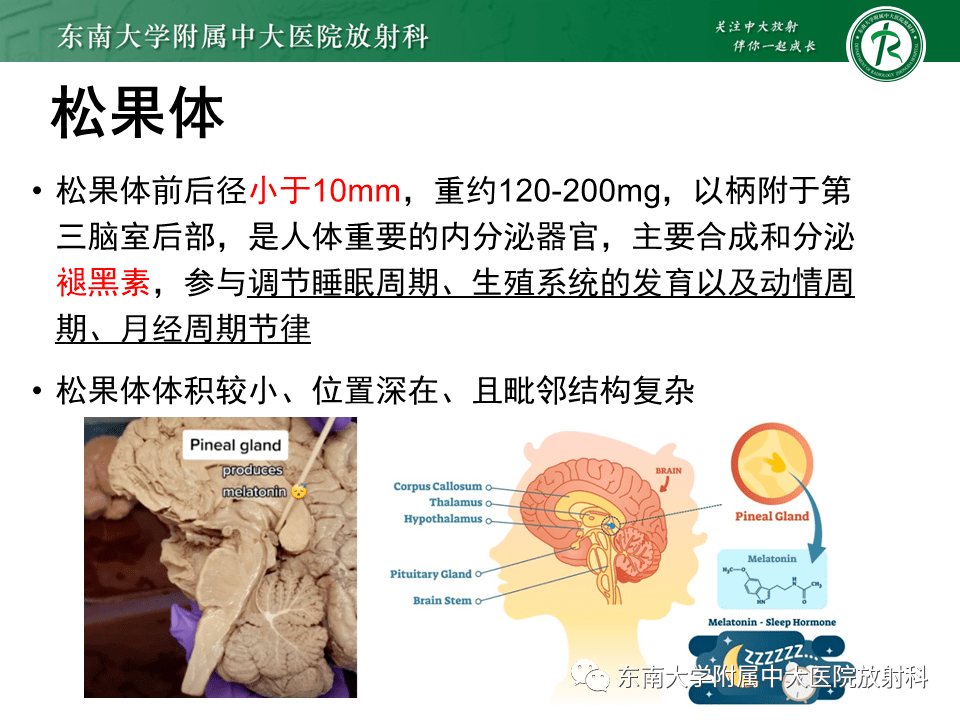 晨讀結果公佈20210816神經系統疾病病例1松果體實質腫瘤病例2生殖細胞