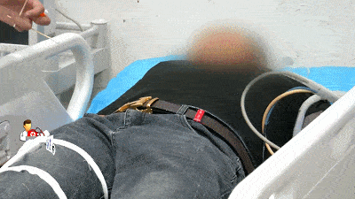 右腿粉碎性骨折痛到全身发抖说起这场意外男子一脸无奈