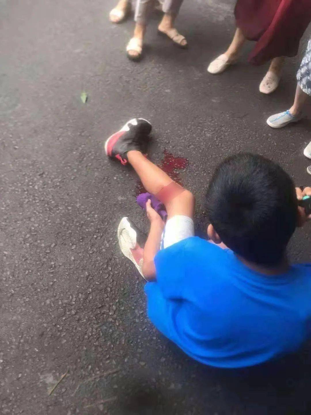 气愤极了自贡一小孩被撞司机逃逸