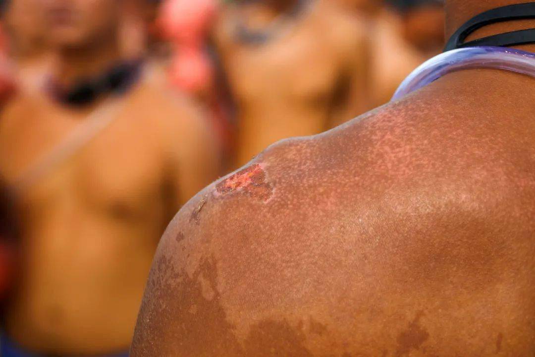 看着都疼战士们海训肩背晒脱皮网友这才是真正的男神