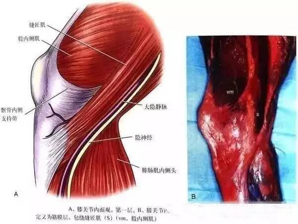 圖4:膝關節內面觀,第一層內側副韌帶淺層主要發揮抵抗外翻應力的作用