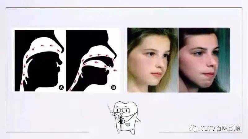 来看一对双胞胎的面容对比会怎样?