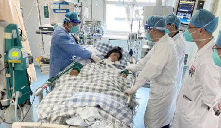 抢救|女子发烧不肯就医3周后住进ICU