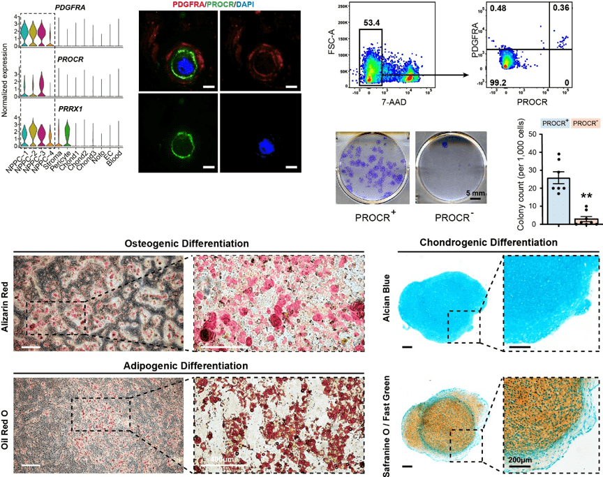 脊柱|专访｜脊柱“缓震器”磨损何解？中国绘首份椎间盘单细胞图谱