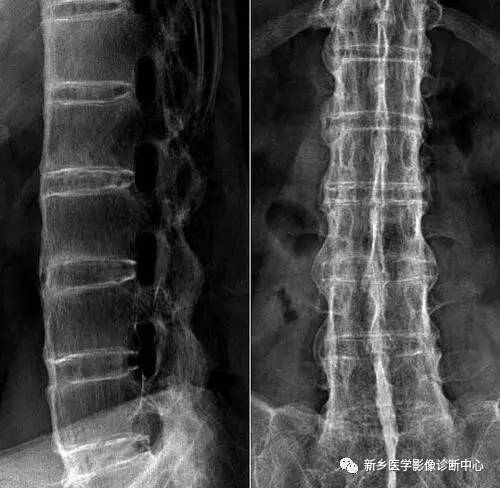 弹簧|图解21种腹部疼痛原因