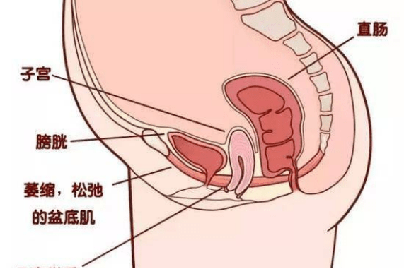 腹部脂肪的堆积会导致盆底肌负重加剧