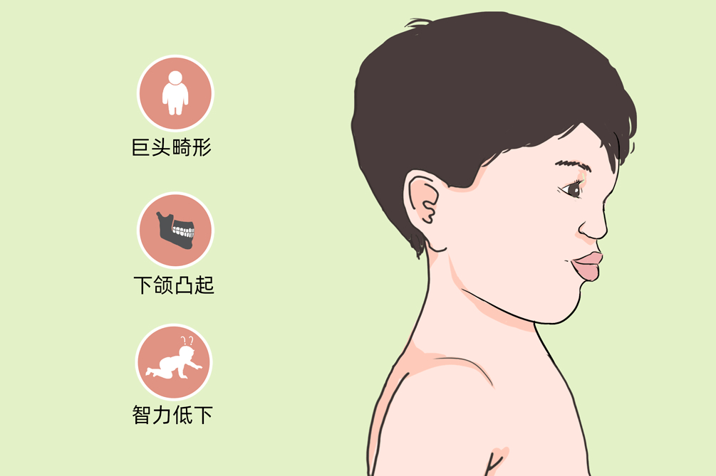 全国残疾预防日 