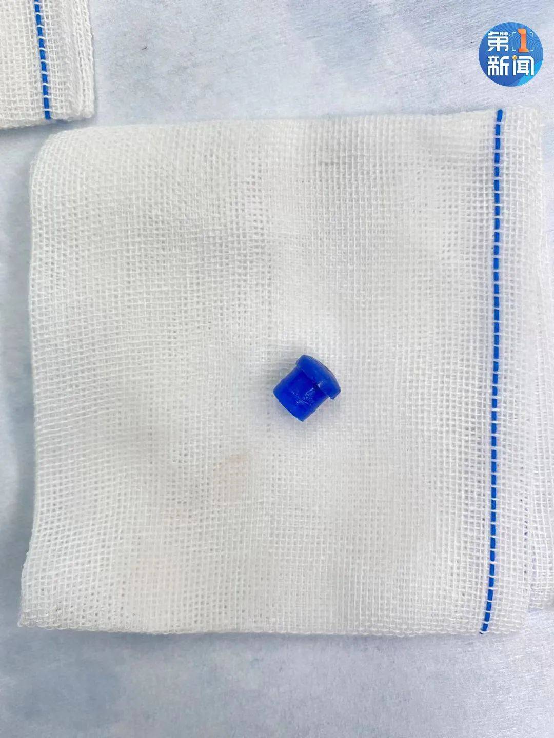 手术|9岁男孩学习时突然呼吸困难，急转至西安手术，惹祸的竟是它！