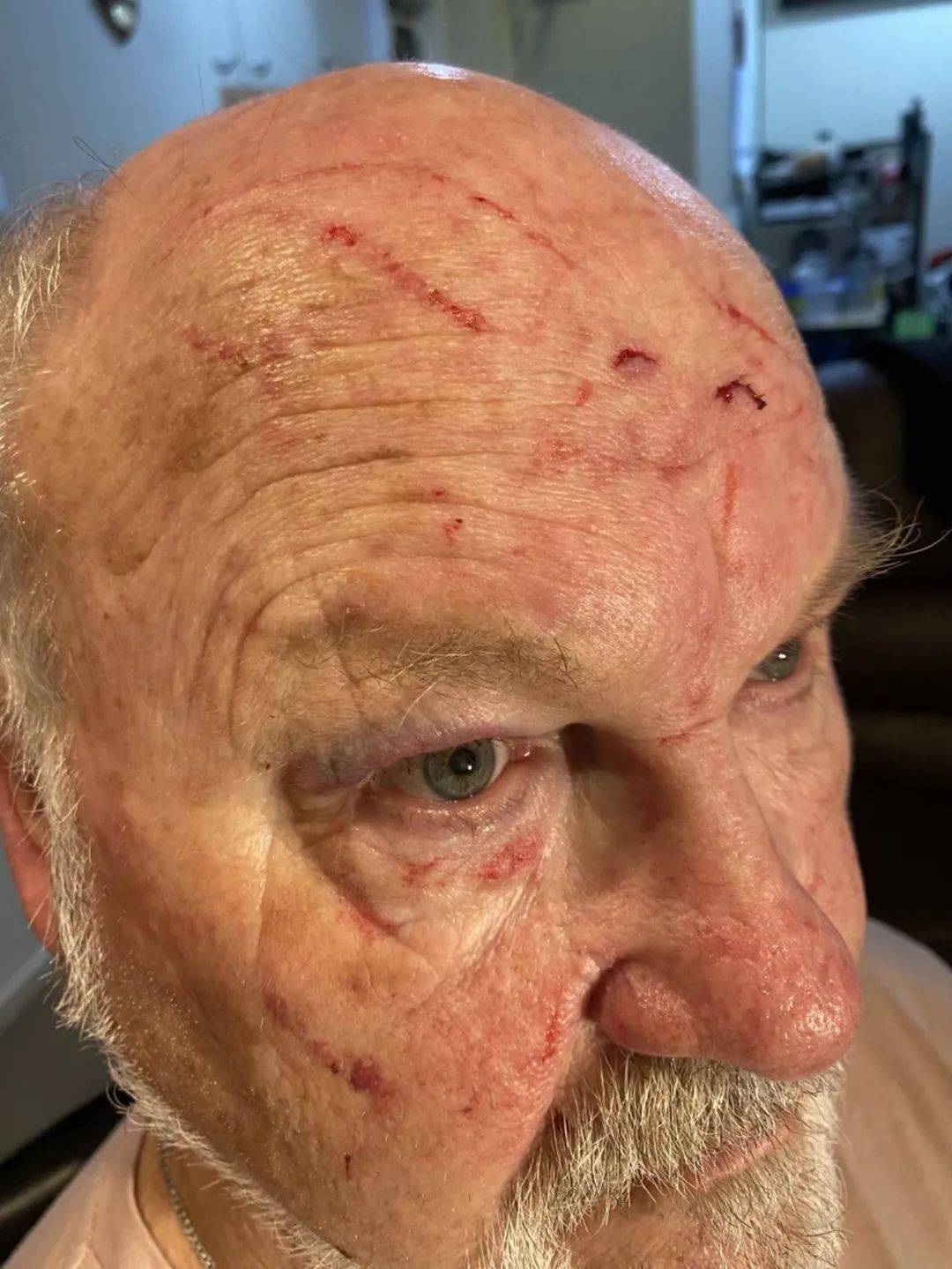 其中一个女孩甚至试图用她的指甲,挖司机的眼睛.