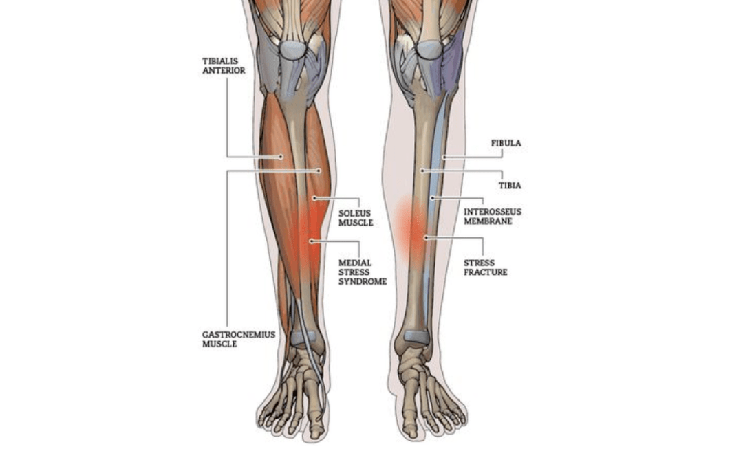 小腿内侧疼痛部位图解图片