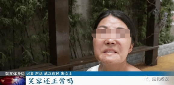 症状|说好的整成舒淇同款鼻,结果连微笑都成问题!更麻烦的是……