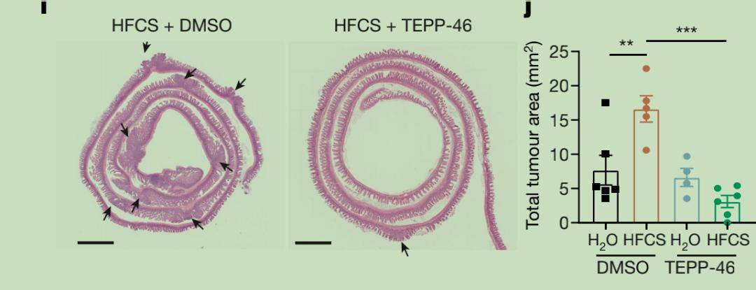 长度|奶茶催人胖：果糖使肠道绒毛增长40%，促进营养吸收