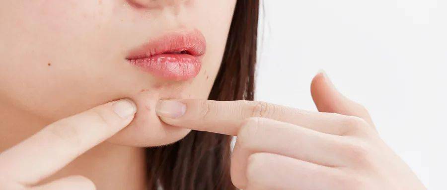 青少年|只要青春不要痘