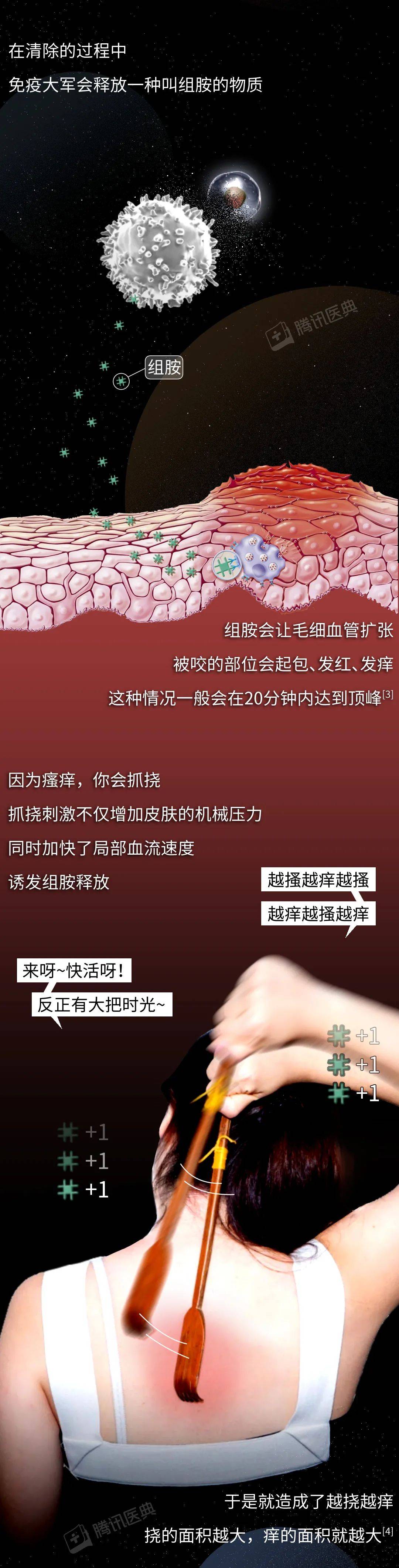 评论|被蚊子咬了，再痒也别挠，教你3招马上止痒