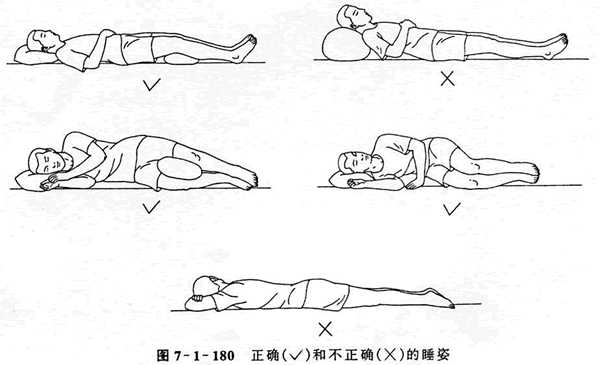 14岁少女脊柱侧弯