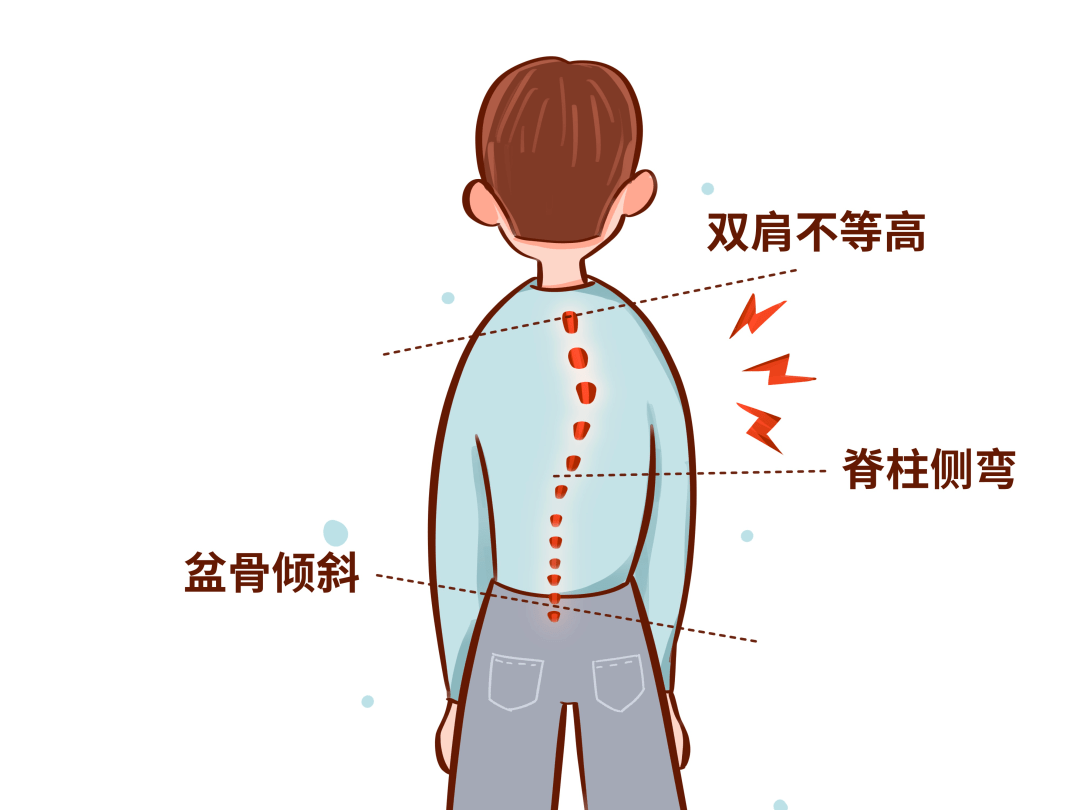 孩子含胸驼背高低肩怎么破?温州市运动医学中心专家教你五招