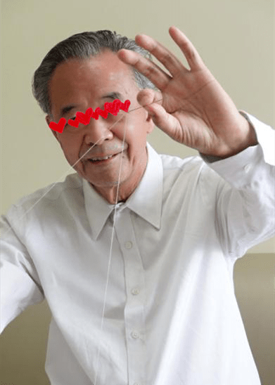 视力|治白内障同时治近视，新方案成就歌唱大赛最高龄选手
