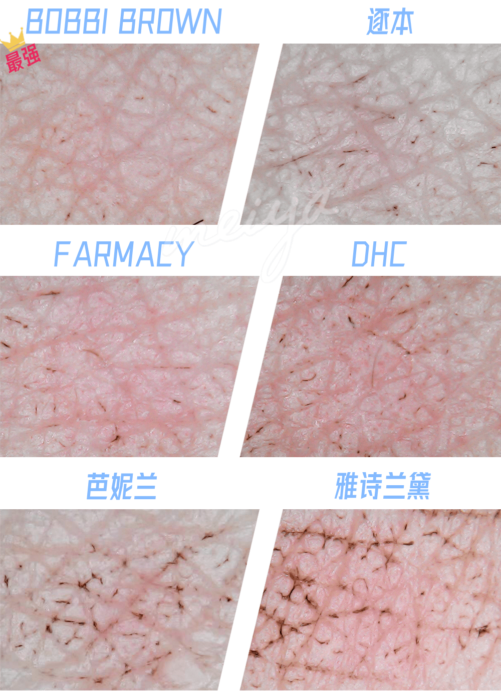 因为|当皮肤放大1000倍，脏得我震惊了！