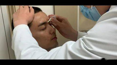 脸部|吴磊拍马战戏时脸部意外被炸伤 坚持拍完才赴医院包扎