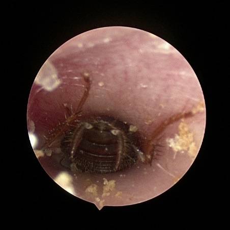 蟑螂|一觉醒来耳朵剧痛，原因竟是爬进这种昆虫