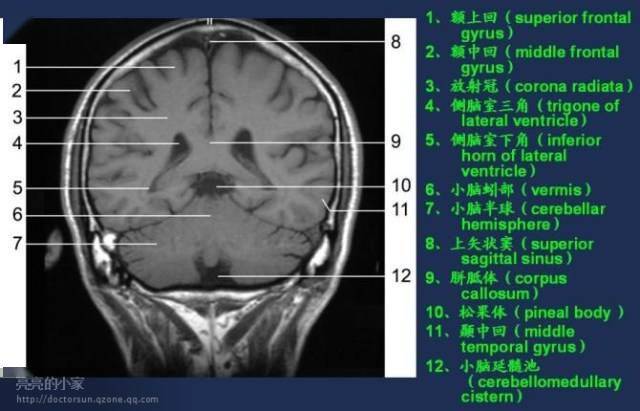 全身MRI解剖图谱，影像科医生必备！_手机搜狐网