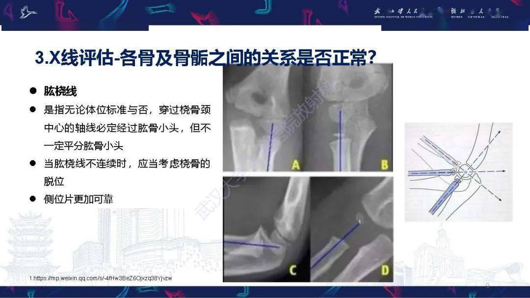 兒童肘關節外傷x線診斷_解剖圖