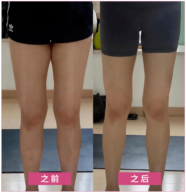 穿拖鞋也能瘦全身吴昕大s力荐每天踩一踩翘pp细长腿女明星们人手一双