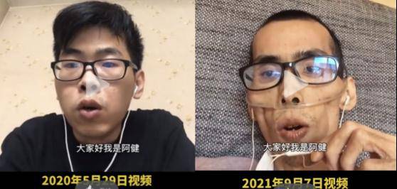 抗癌|抗癌博主去世，这10个重要提醒一定要看完