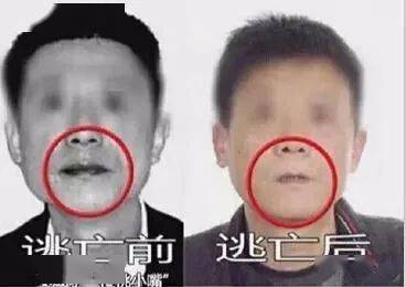 广告|吃了半年，左脸彻底溃烂：这款热门零食，正在危害6000万人的身体......