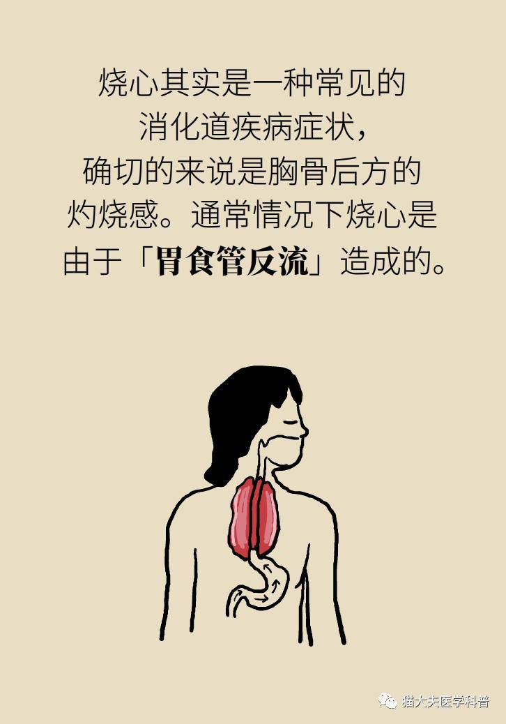 烧心|烧心烧得难受？6个方法可缓解
